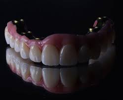 Full Mouth Implants in Brentwood
