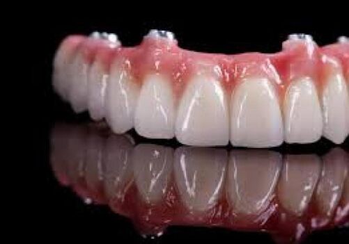 Dental Implants Brentwood Residents Trust