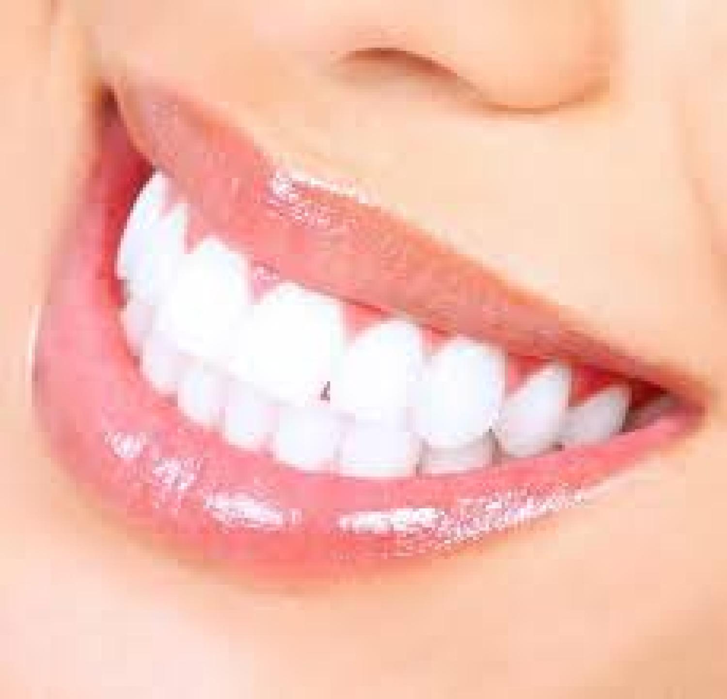 The Secrets to a Brighter Smile for Patients in Brentwood, Antioch, Oakley and Discovery Bay