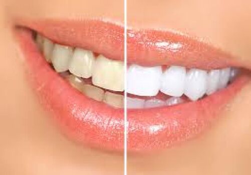 The Secrets to a Brighter Smile for Patients in Brentwood, Antioch, Oakley and Discovery Bay