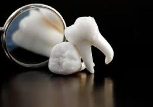 Emergency Dentist in Brentwood for Possible Same Day Treatment