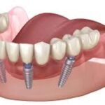 Sedation dentistry, brentwood, anxiety visits
