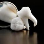 Wisdom Teeth, Brentwood Dentist, Dr. Ton, Teenagers