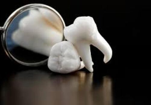 Wisdom Teeth, Brentwood Dentist, Dr. Ton, Teenagers