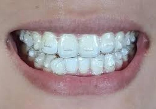 Implant dentist, cosmetic, teeth cleaning, brentwood