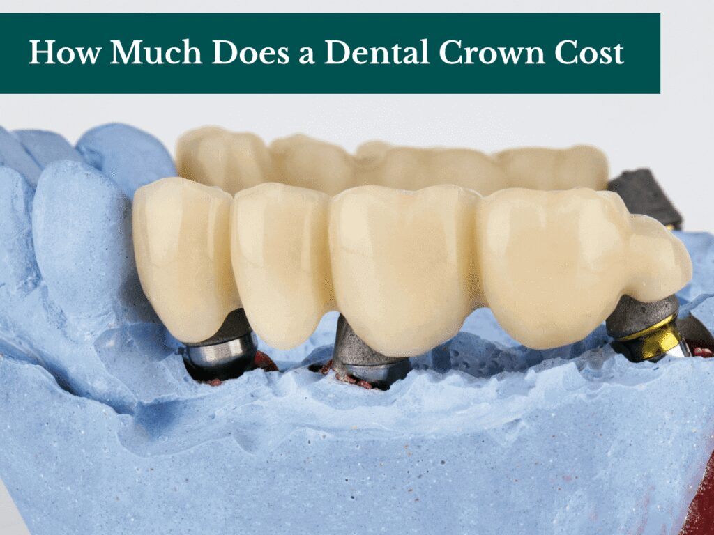 How Much Does a Dental Crown Cost