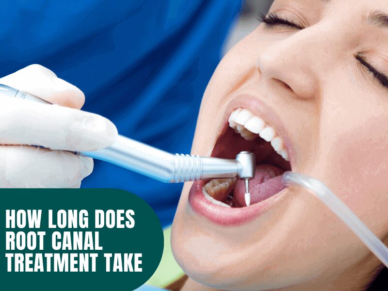 How Long Does Root Canal Treatment Take