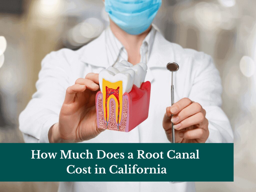 How Much Does a Root Canal Cost in California
