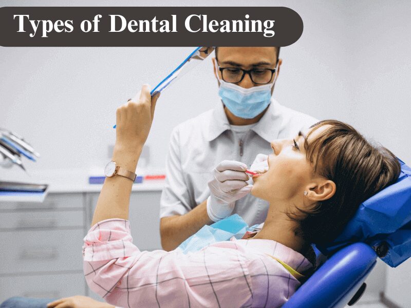 4 Types of Dental Cleaning: Essential Methods Explained