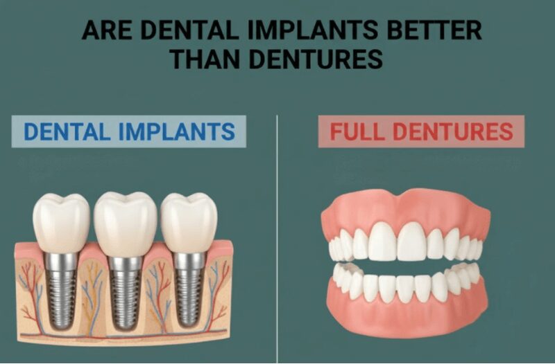 Are Dental Implants Better Than Dentures? 